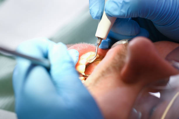 Best Knocked-Out Tooth Emergency  in Durand, WI